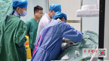 肺部血管畸形引发脑梗塞 十堰人医介入科成功开展肺动静脉瘘介入治疗