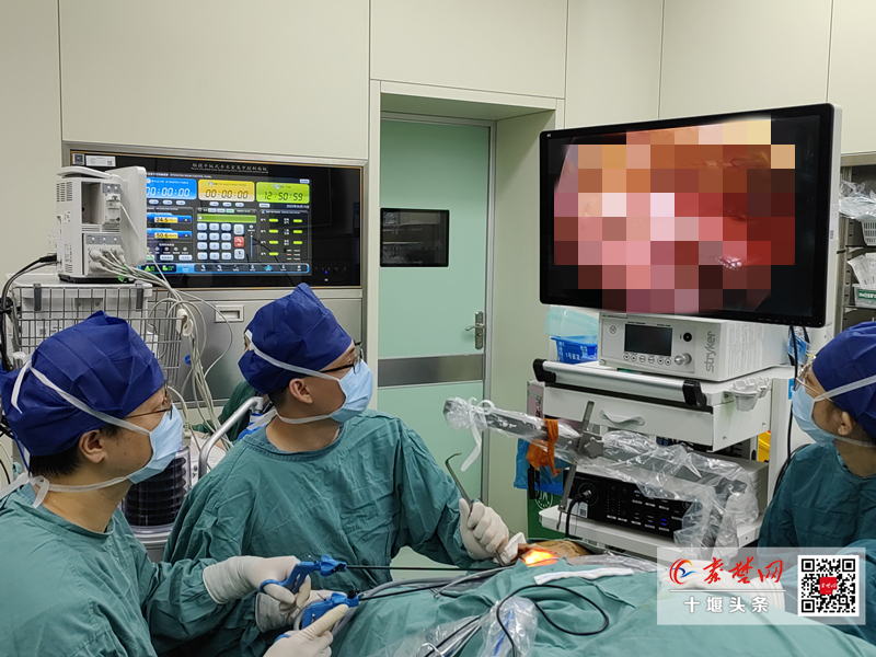 告别面部疤痕！十堰人医引领鄂西北腮腺肿瘤治疗迈入“无痕”时代