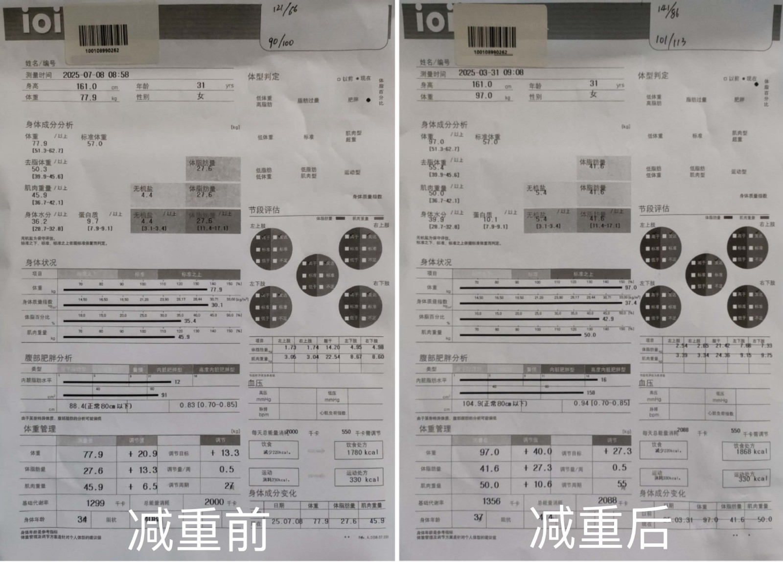 女子科学共管减重19公斤，逆转代谢危机