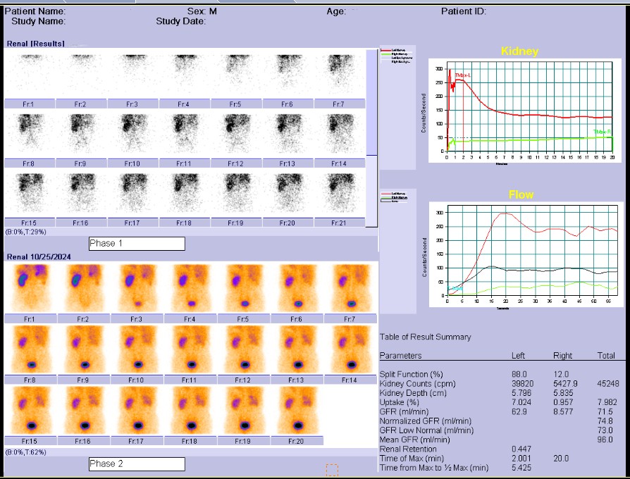 肾动态显像检查流程及注意事项